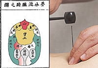 打鍼のための腹診図(左)／打鍼(右)